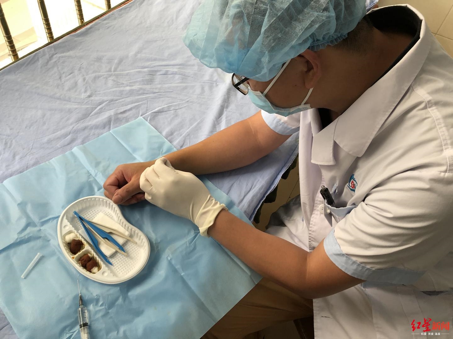 女孩子做完腹腔镜阑尾炎微创手术恢复全过程 - 知乎